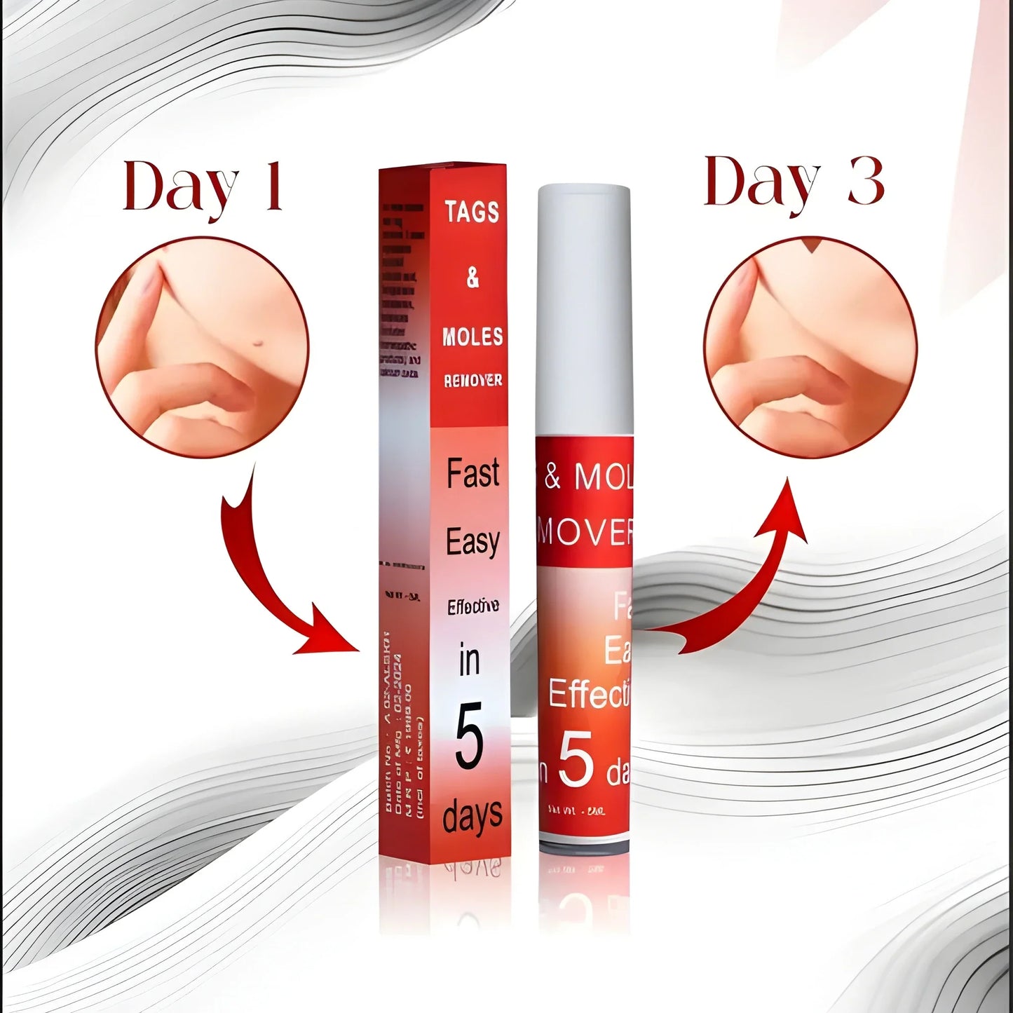 Tags & Moles Remover Cream