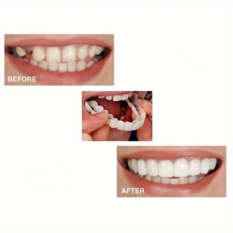 Fit Flex Cosmetic Teeth Denture