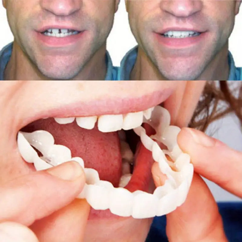 Fit Flex Cosmetic Teeth Denture