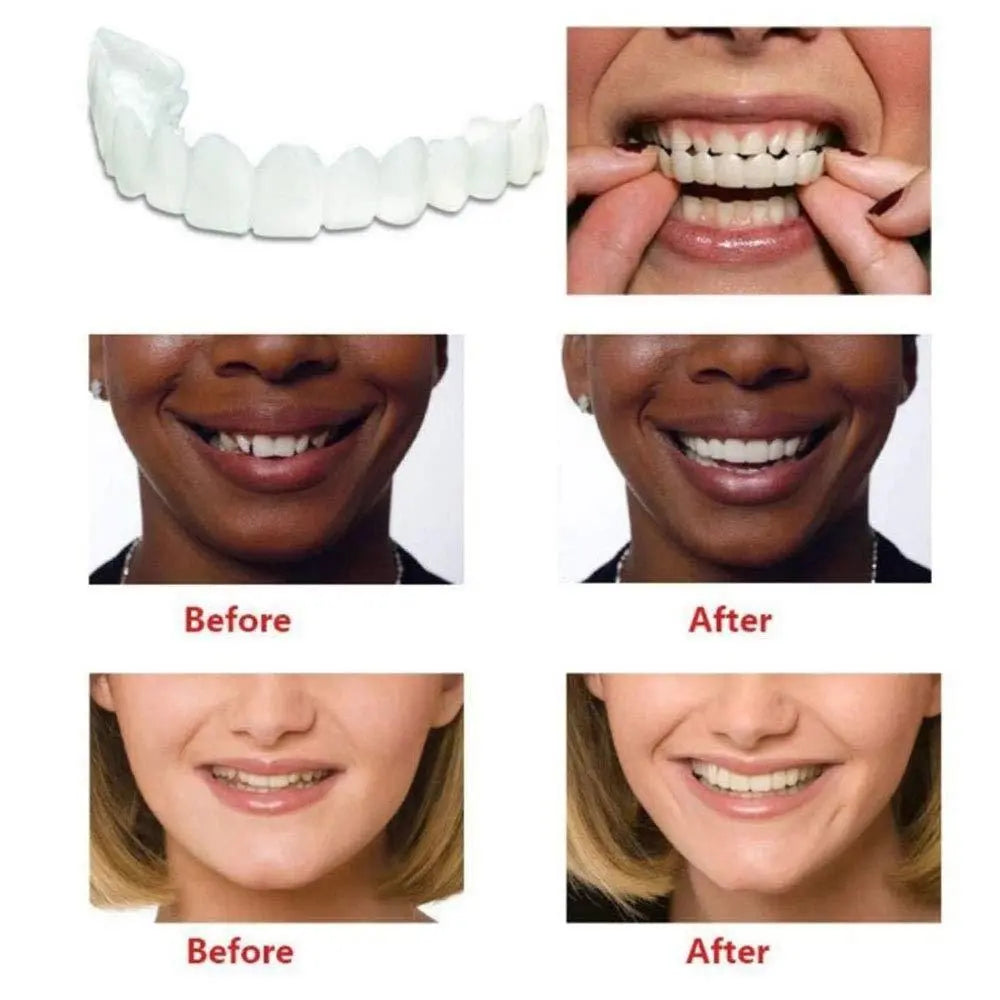 Fit Flex Cosmetic Teeth Denture