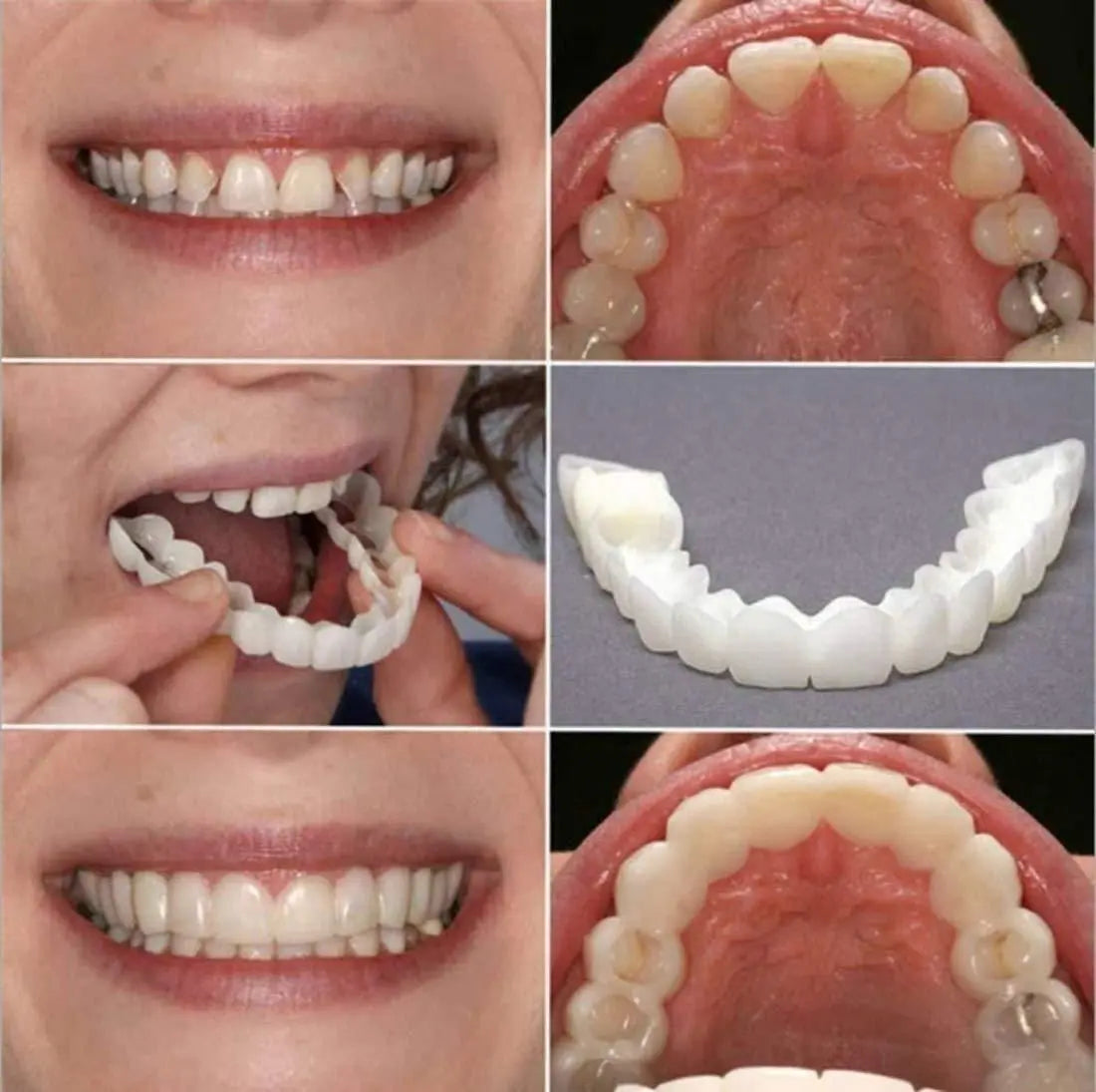 Fit Flex Cosmetic Teeth Denture