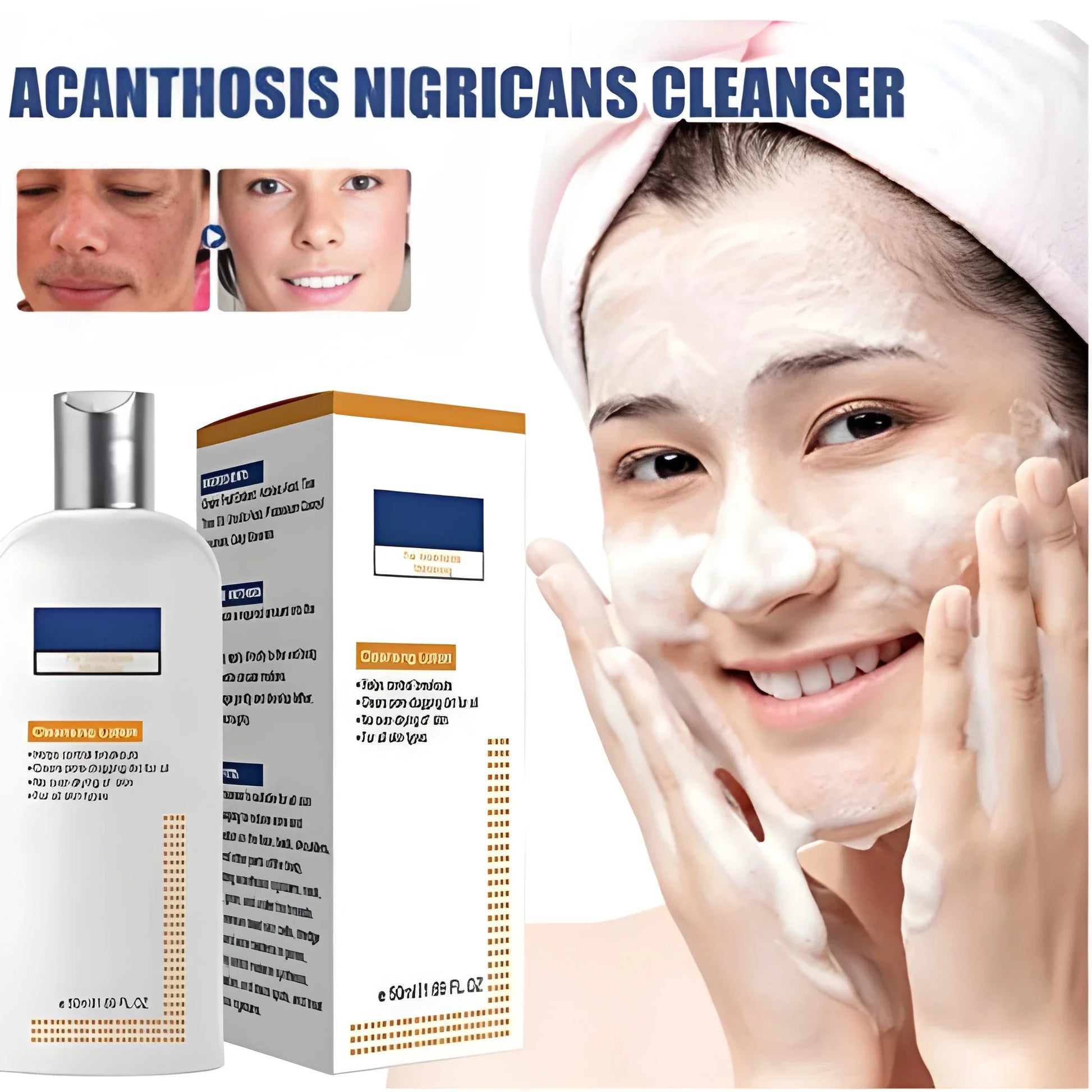 Acne Spot Treatment Lotion