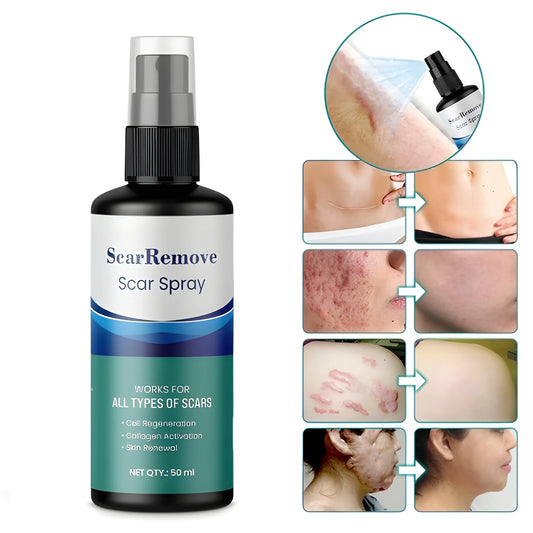 Advanced Scar Removal Spray