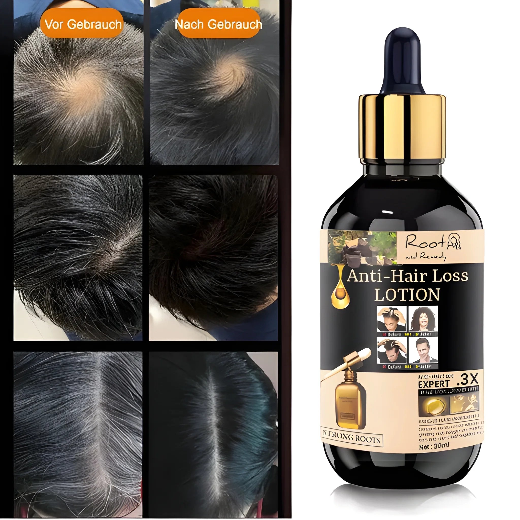 Anti Hair Loss Growth Serum