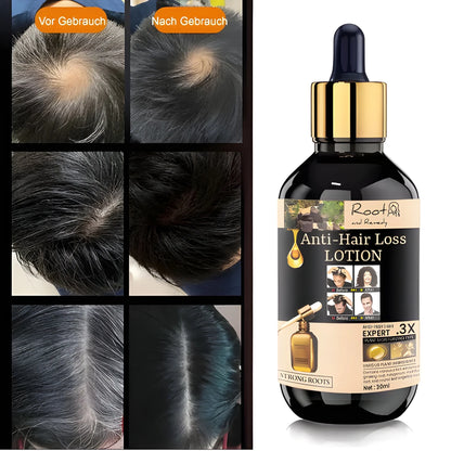 Anti Hair Loss Growth Serum