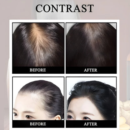 Anti Hair Loss Growth Spray