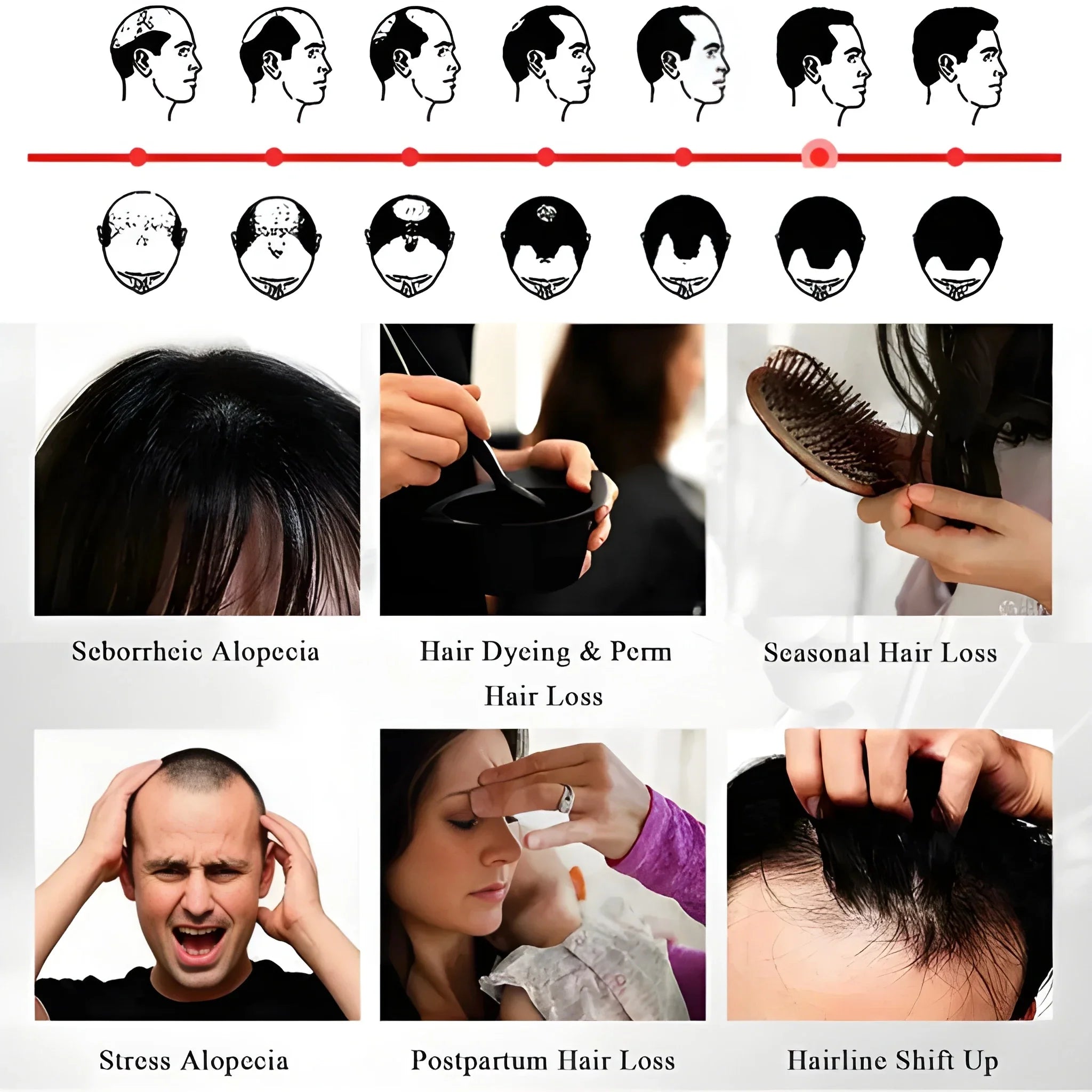 Anti Hair Loss Growth Spray