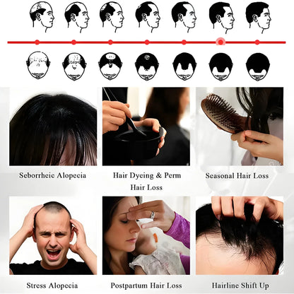 Anti Hair Loss Growth Spray