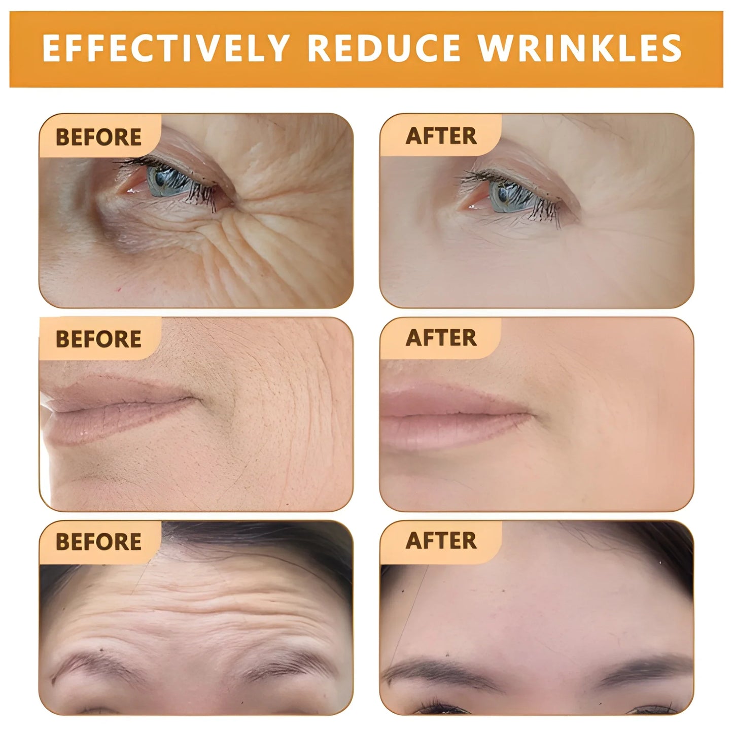 Bee Toxin Anti Aging Cream