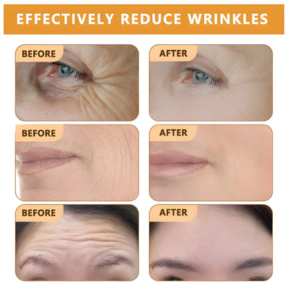 Bee Toxin Anti Aging Cream