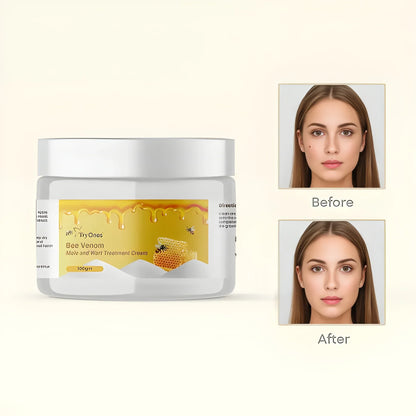 Bee Venom Wart Remover