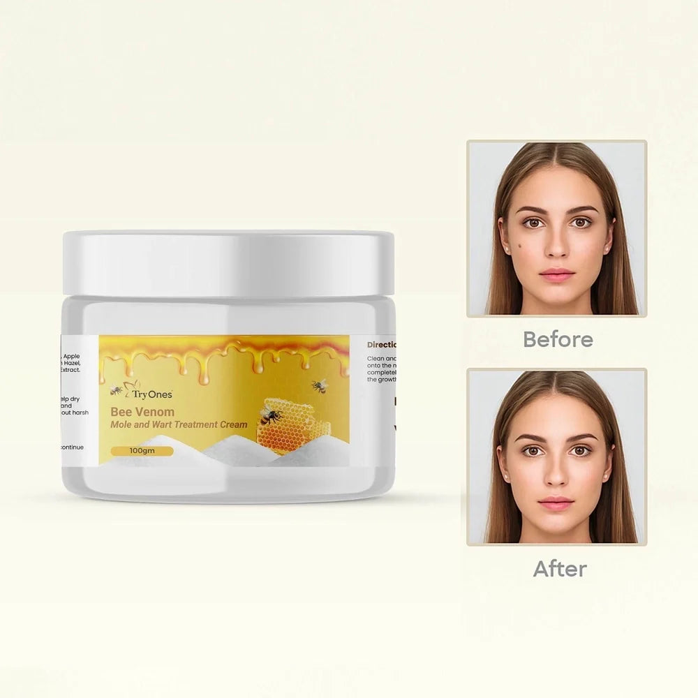 Bee Venom Wart Cream