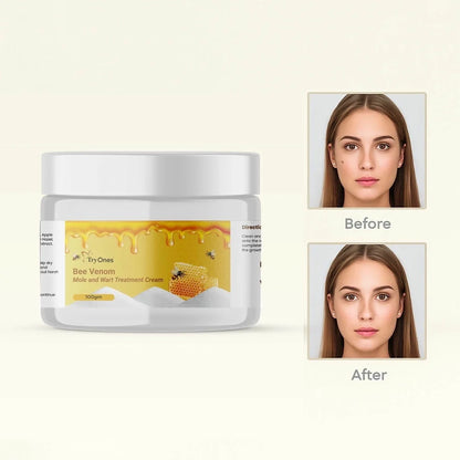 Bee Venom Wart Cream