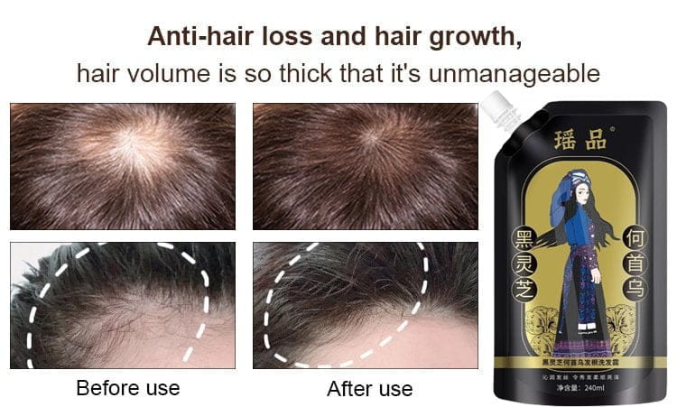 Anti Hair Loss Hair Shampoo 600 ml Pack of 3