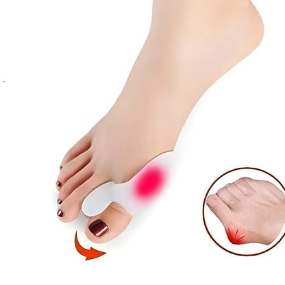 Bunion Relief Separators
