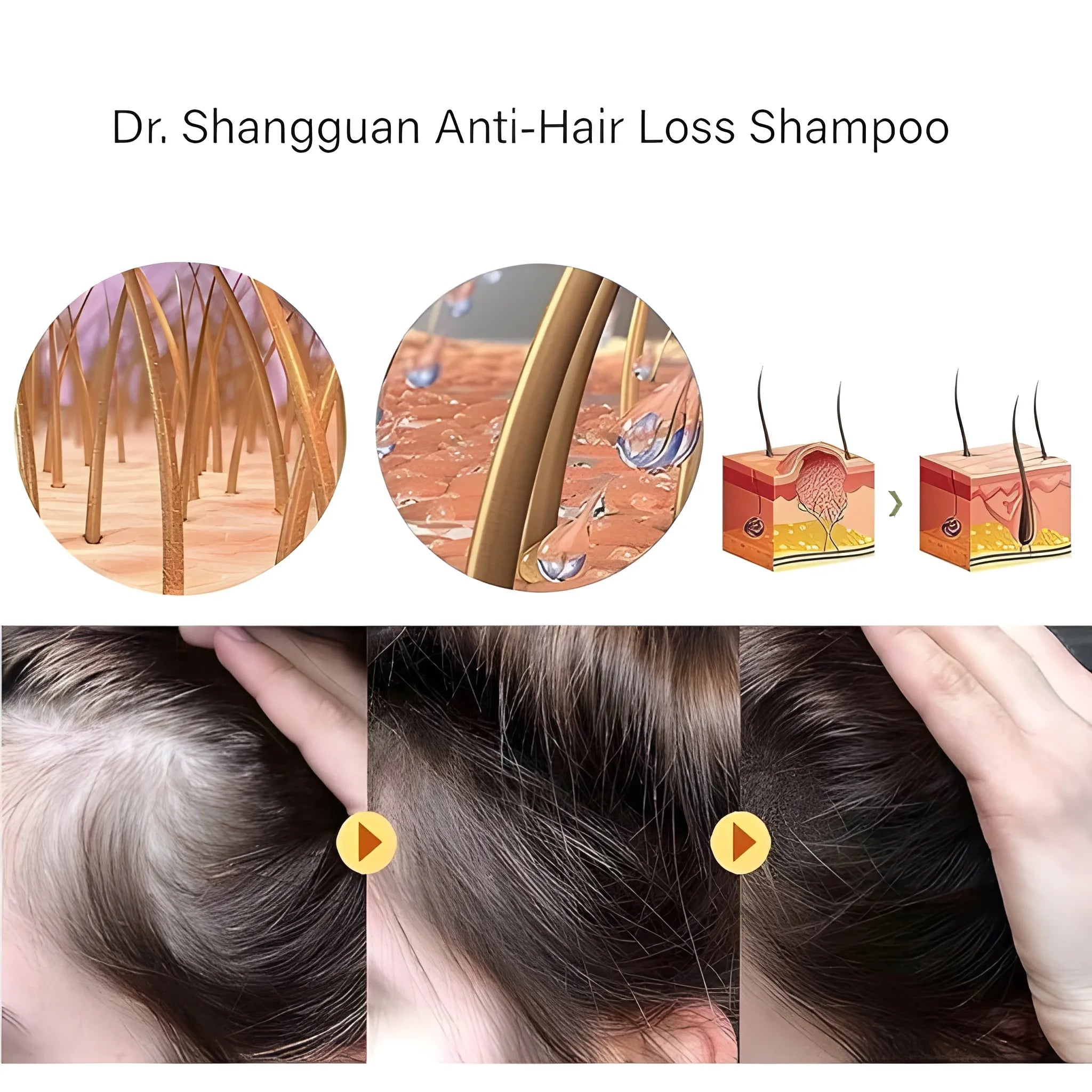 Anti Hair Loss Shampoo