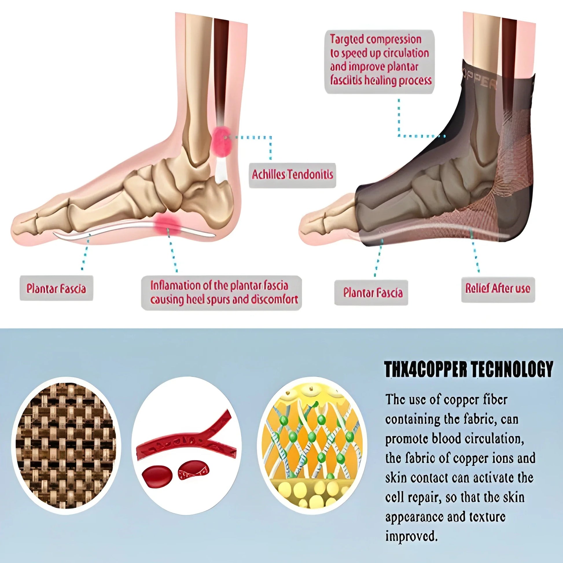 Copper Recovery Foot Sleeves