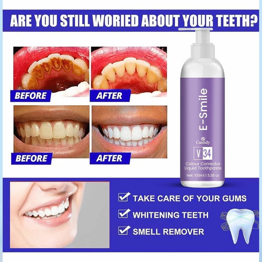E Smile Whitening Toothpaste