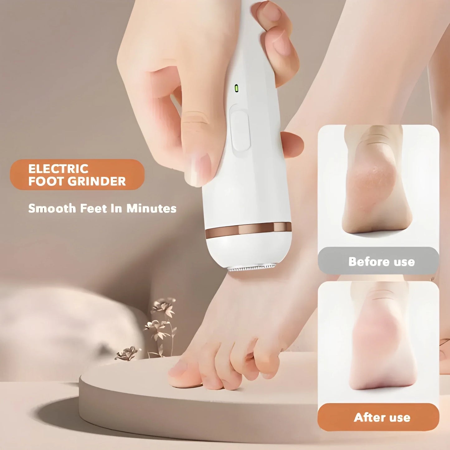 Electric Callus Remover