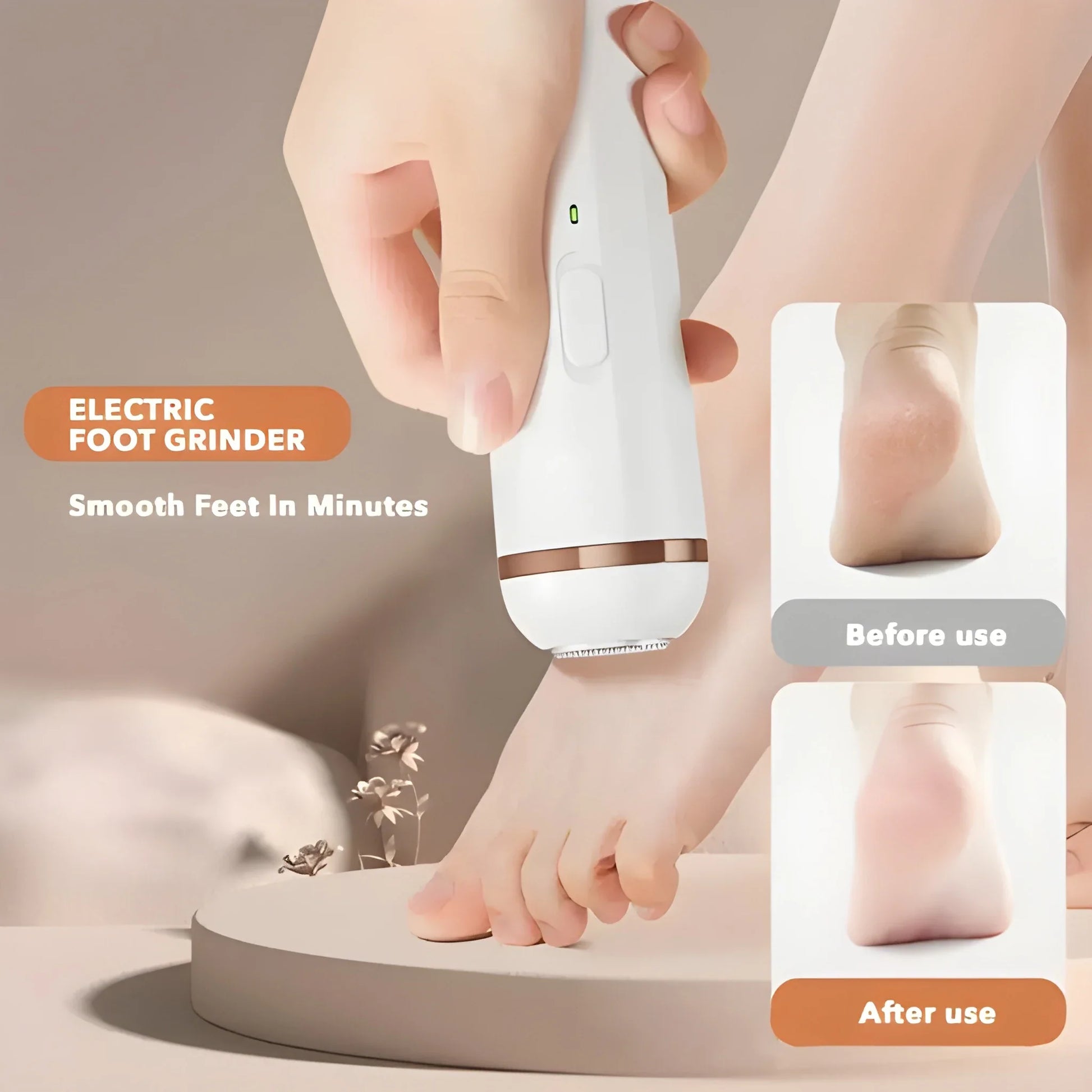 Electric Callus Remover
