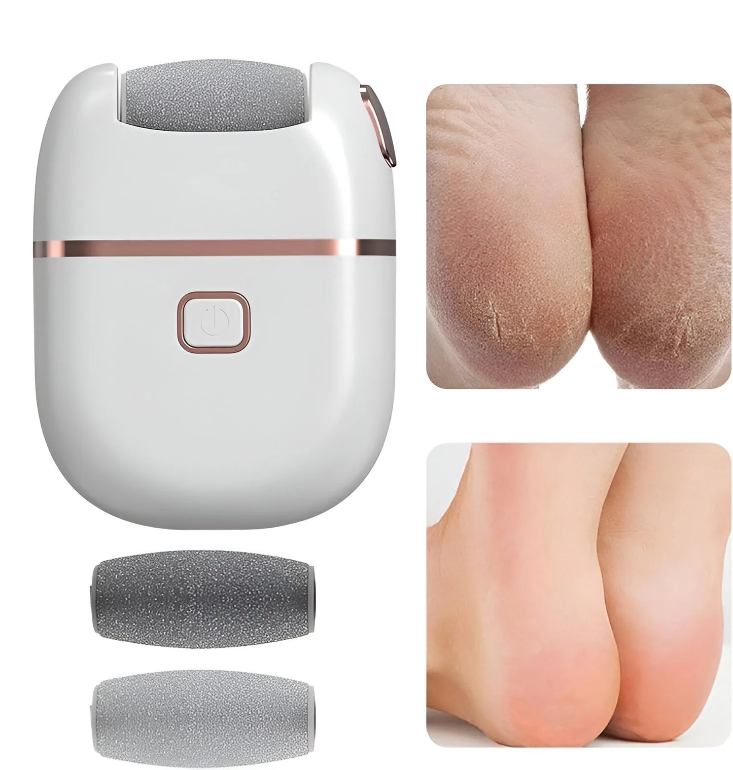 Electronic Pedicure Tool Electronics