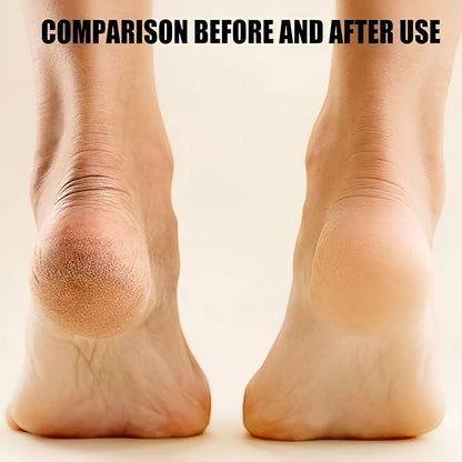 Electronic Pedicure Tool Electronics