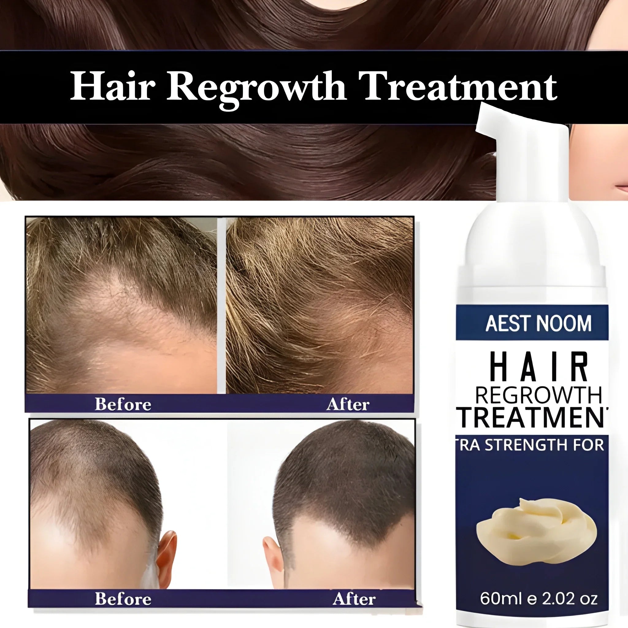 Extra Strength Hair Regrowth