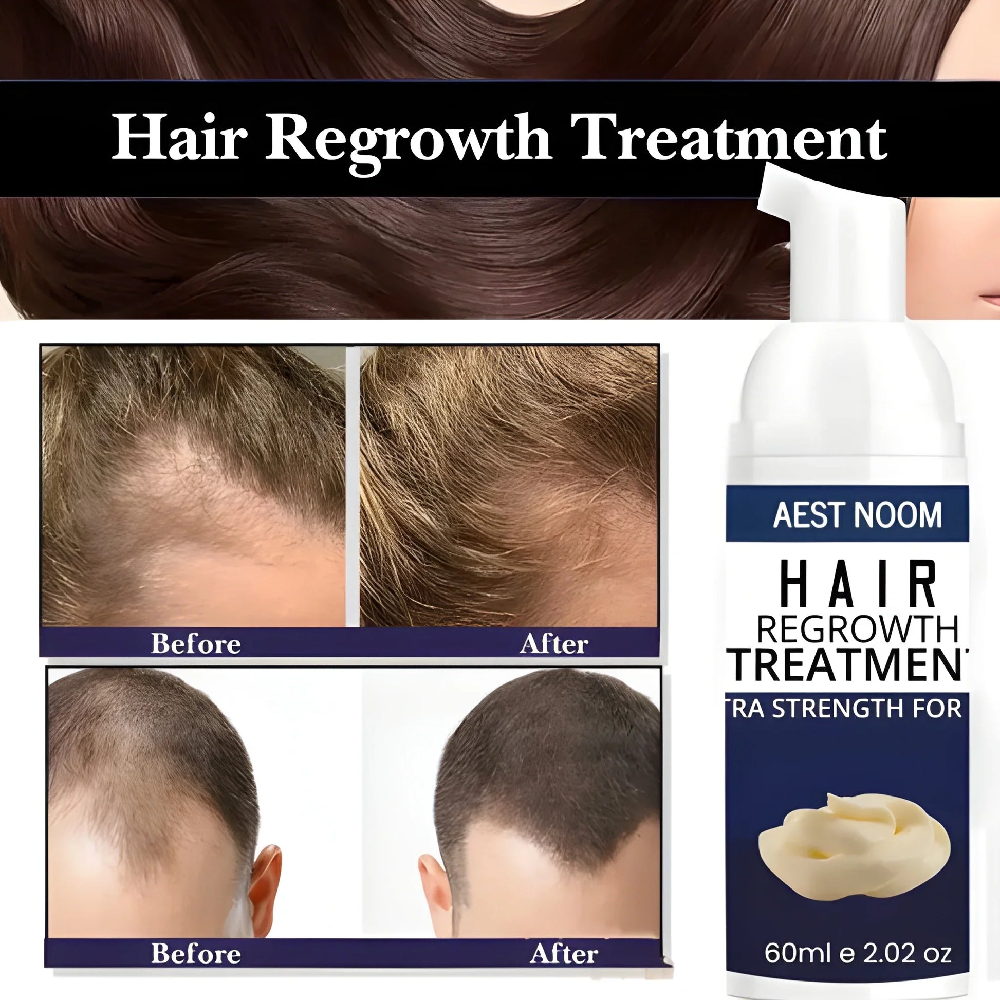 Extra Strength Hair Regrowth