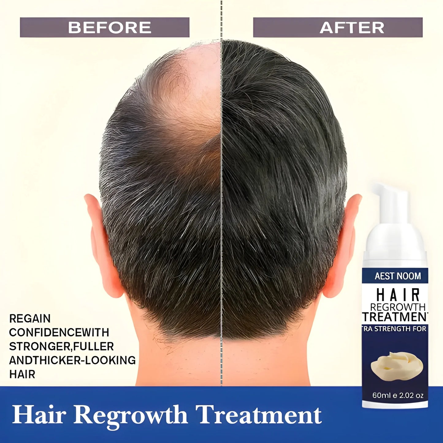 Extra Strength Hair Regrowth