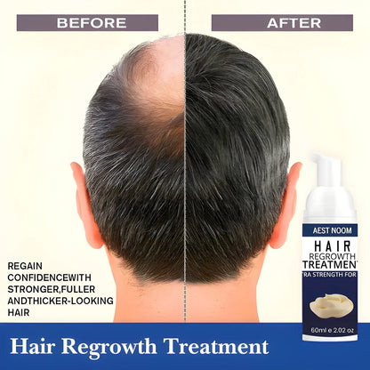 Extra Strength Hair Regrowth