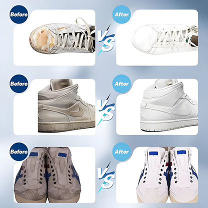 Fezora Sports & Sneaker Cleaner Kit 150 ml