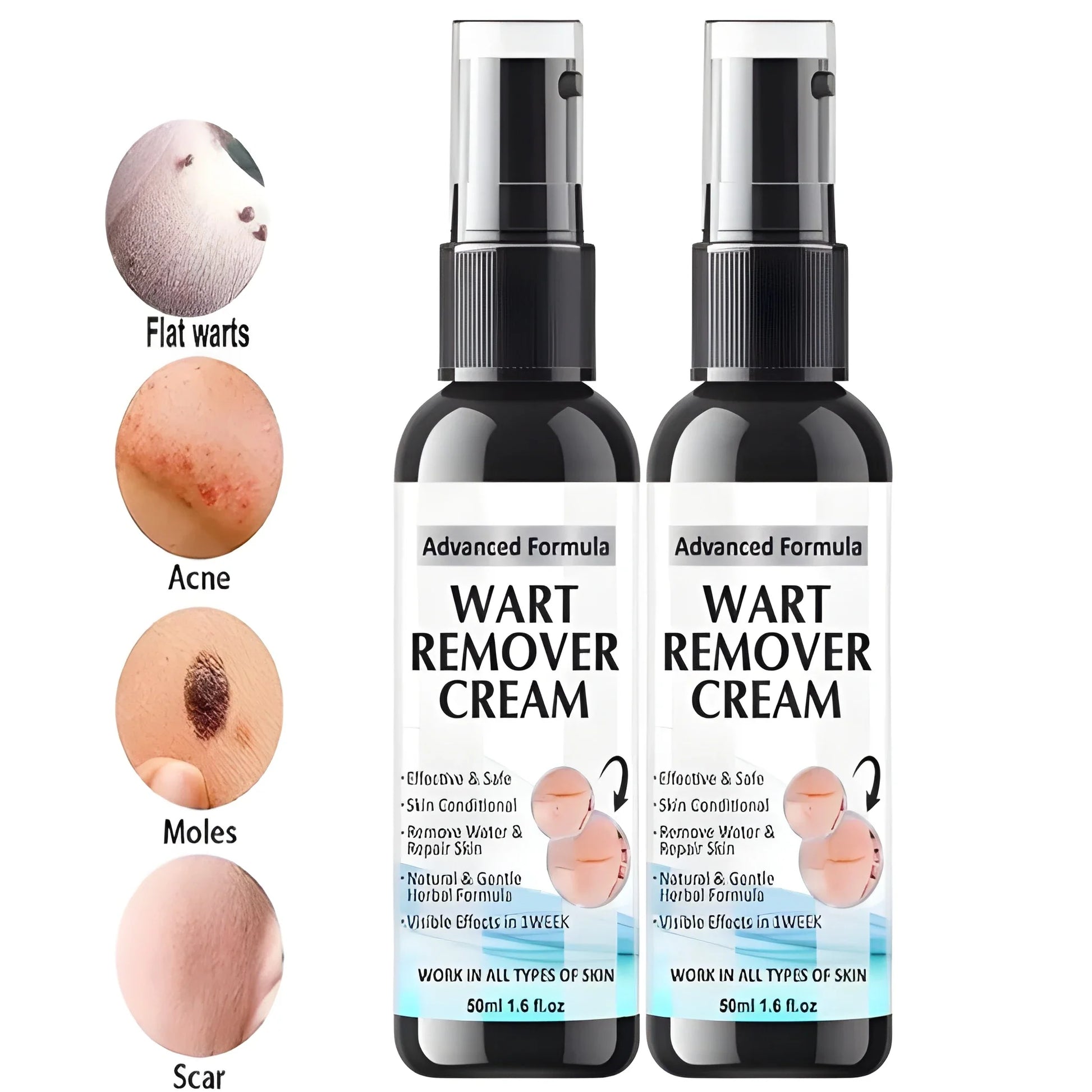 Fezora Wart Remover Cream – Pack of 2