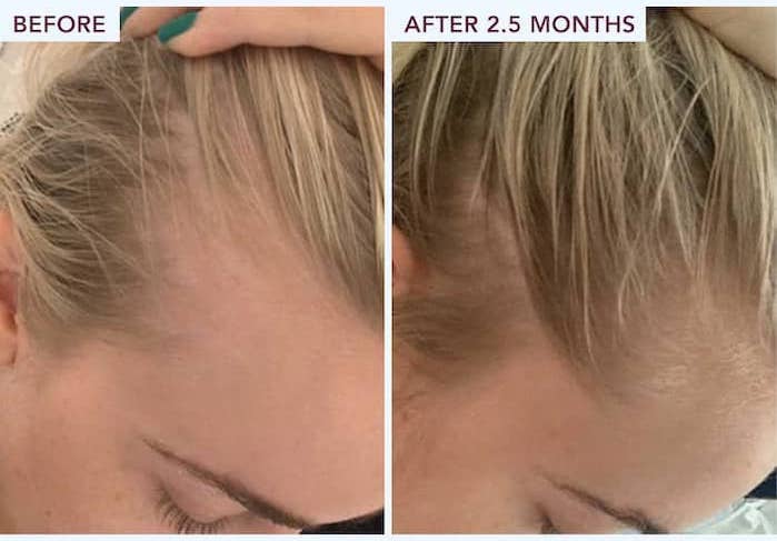 Expert Tips: Maintaining Healthy Hair Post-Relaxer Treatment | FullyVital