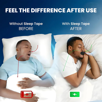 Easy Breathing Mouth Tape – 30 Pcs