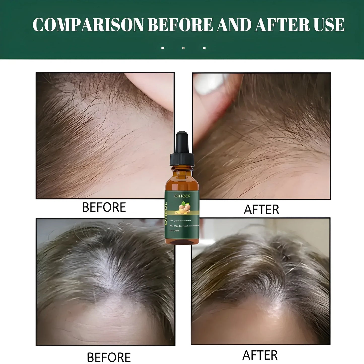 Ginger Hair Growth Serum