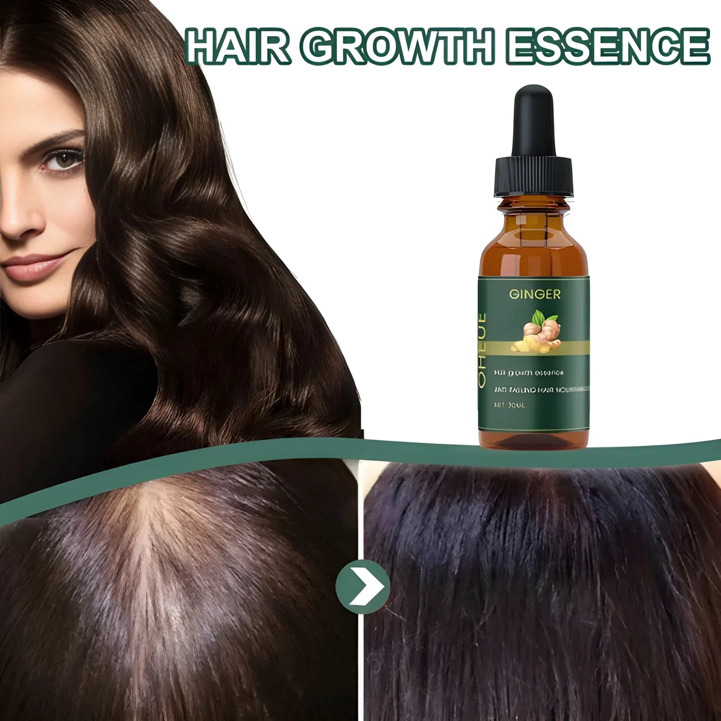 Ginger Hair Growth Serum