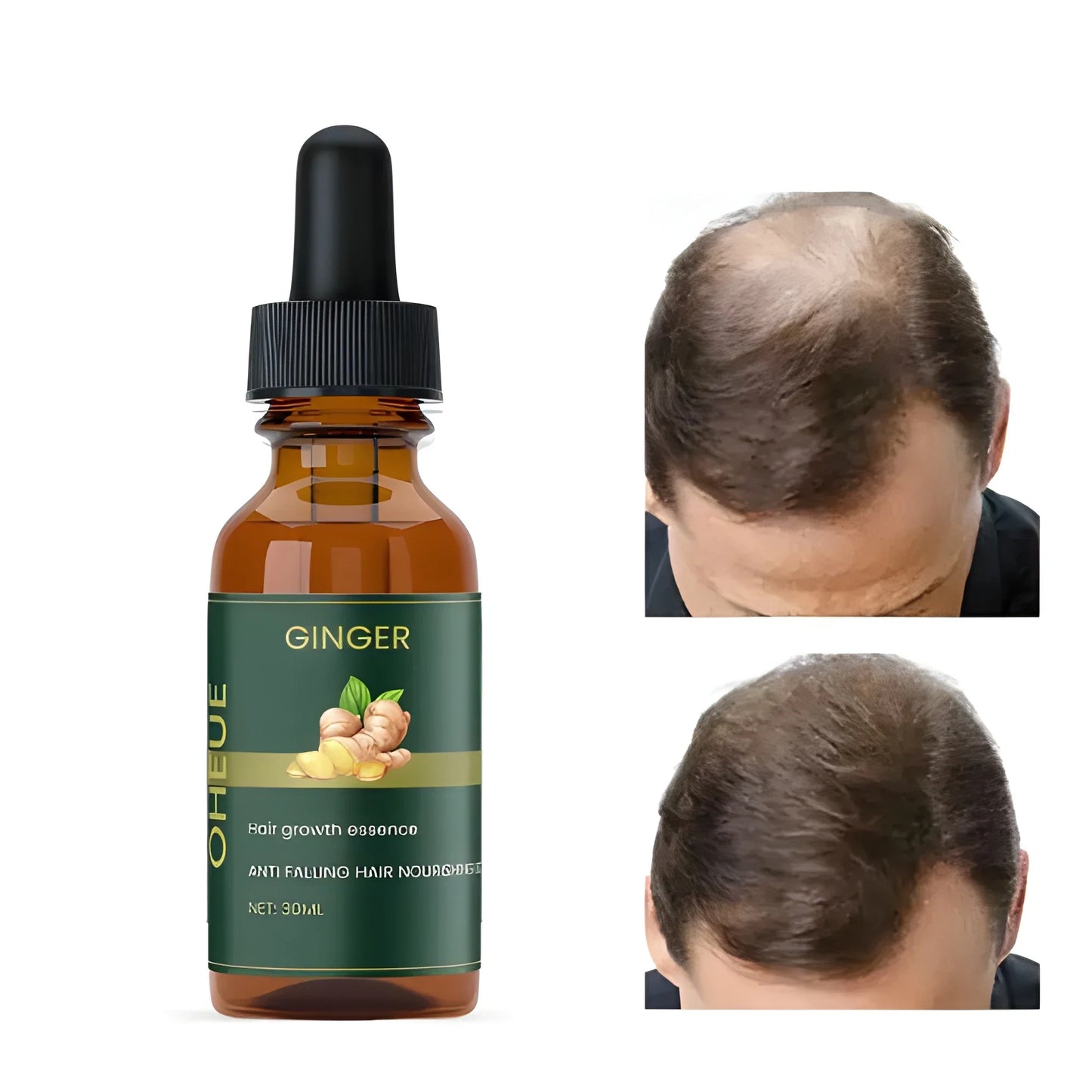 Ginger Hair Growth Serum