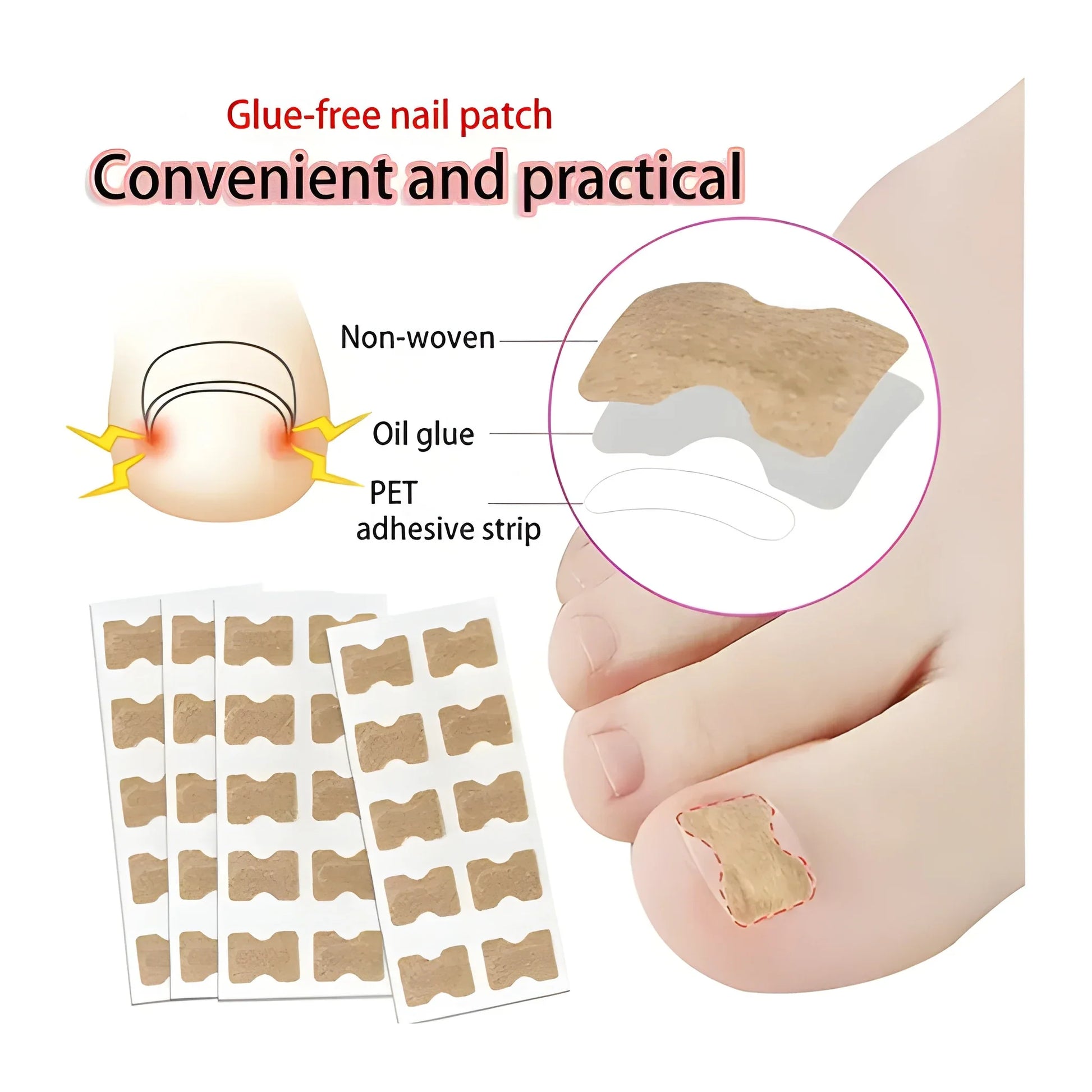 Ingrown Toenail Corrector Stickers