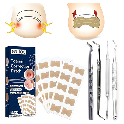 Ingrown Toenail Corrector Stickers