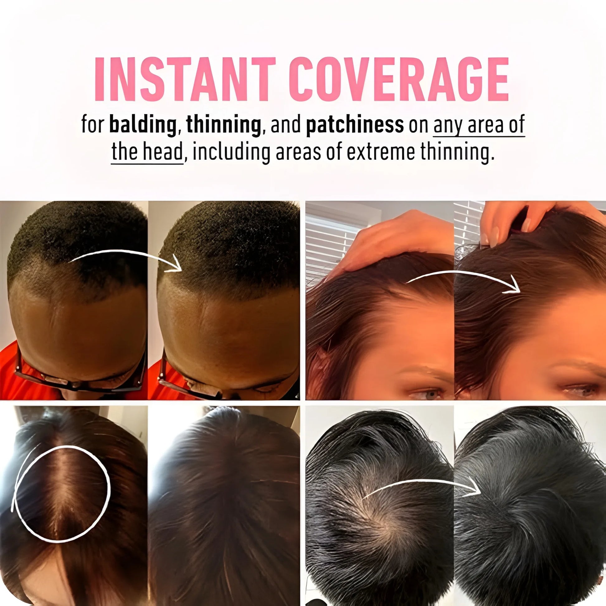 Instant Hair Loss Powder