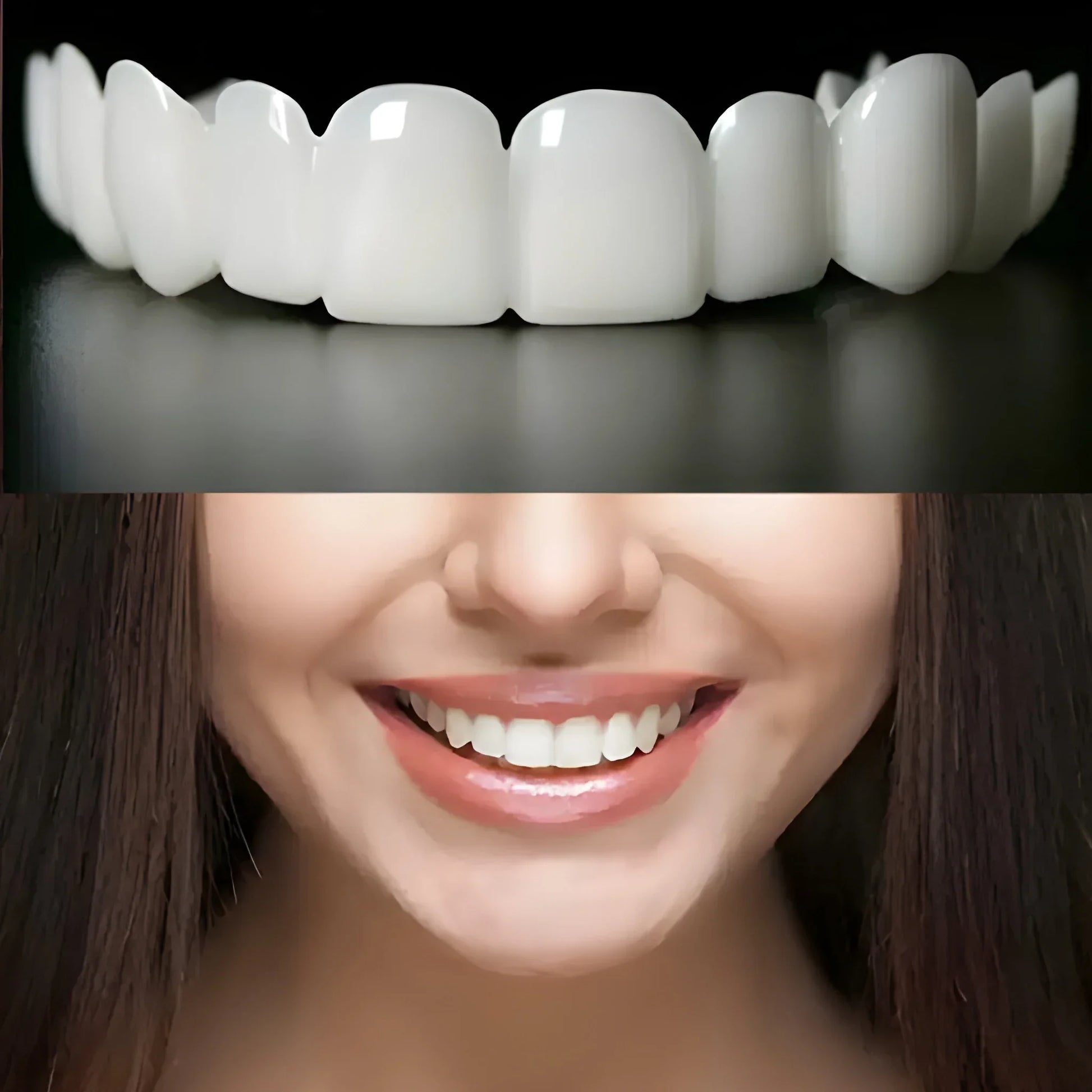 Instant Smile Veneers