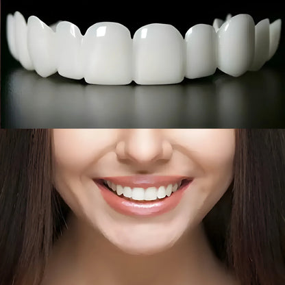 Instant Smile Veneers