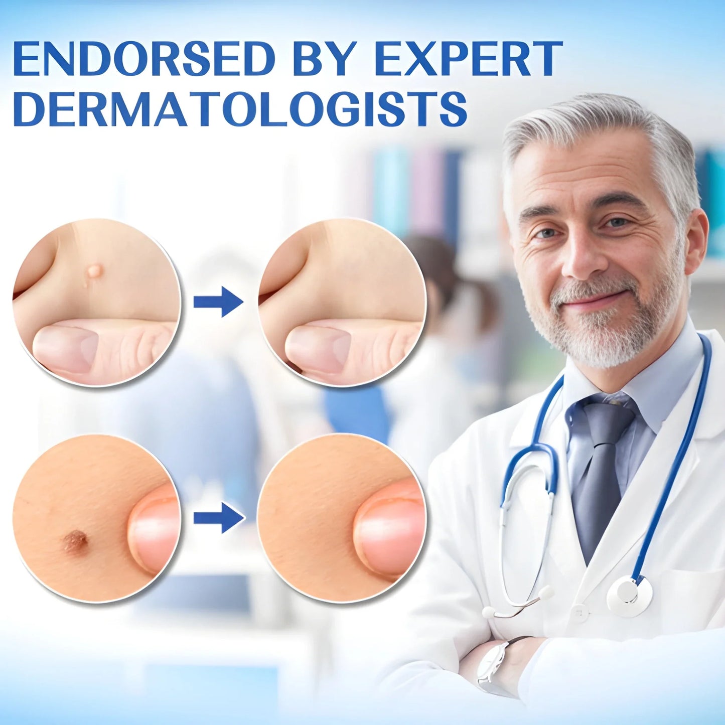 Intimate Wart Remover Cream