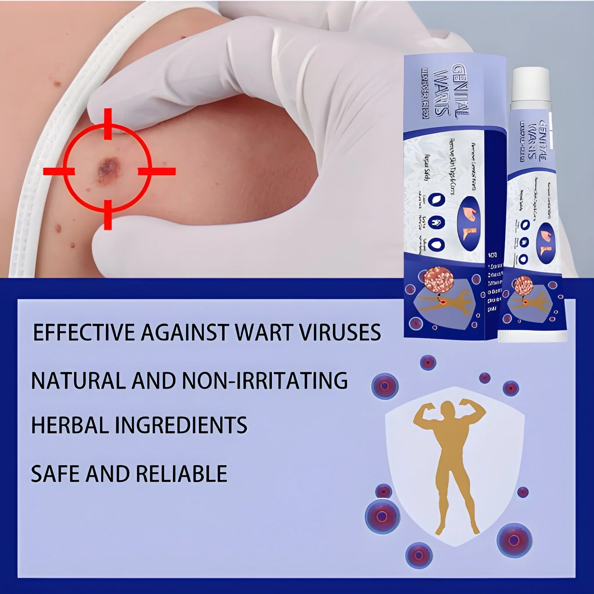 Intimate Wart Remover Cream