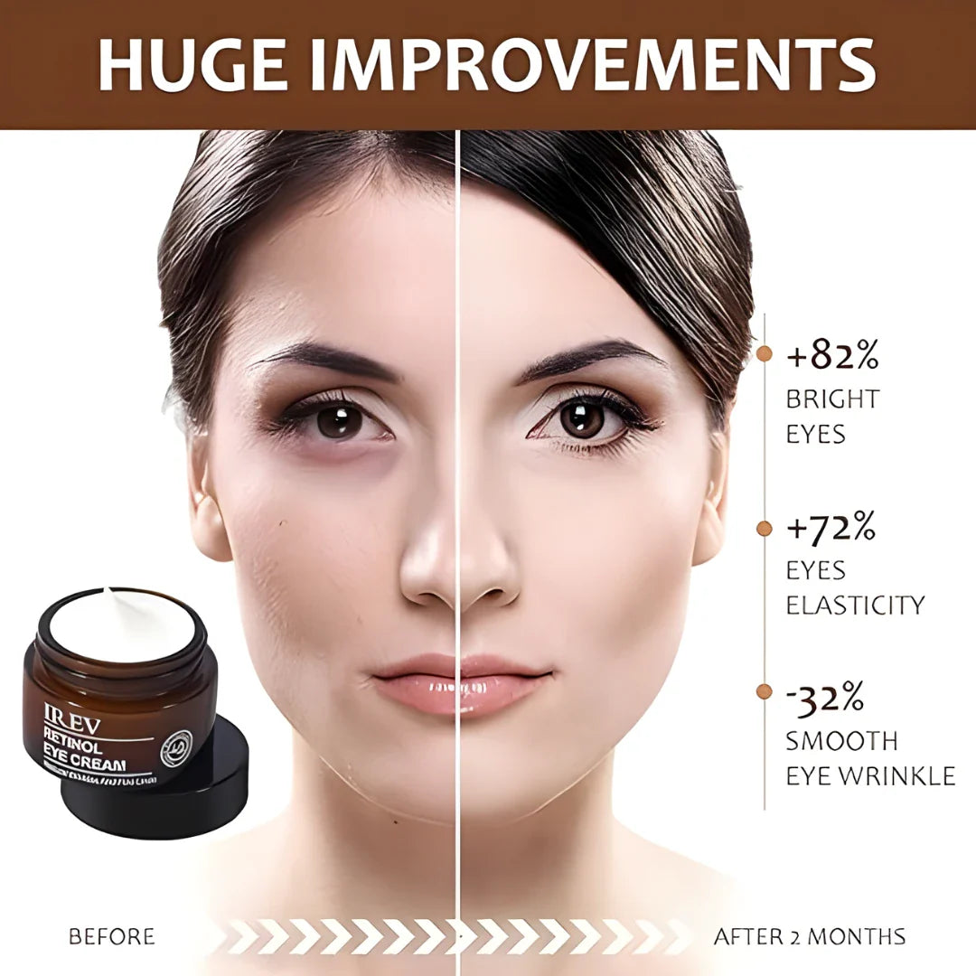 IREV Retinol Eye Cream 30 ml