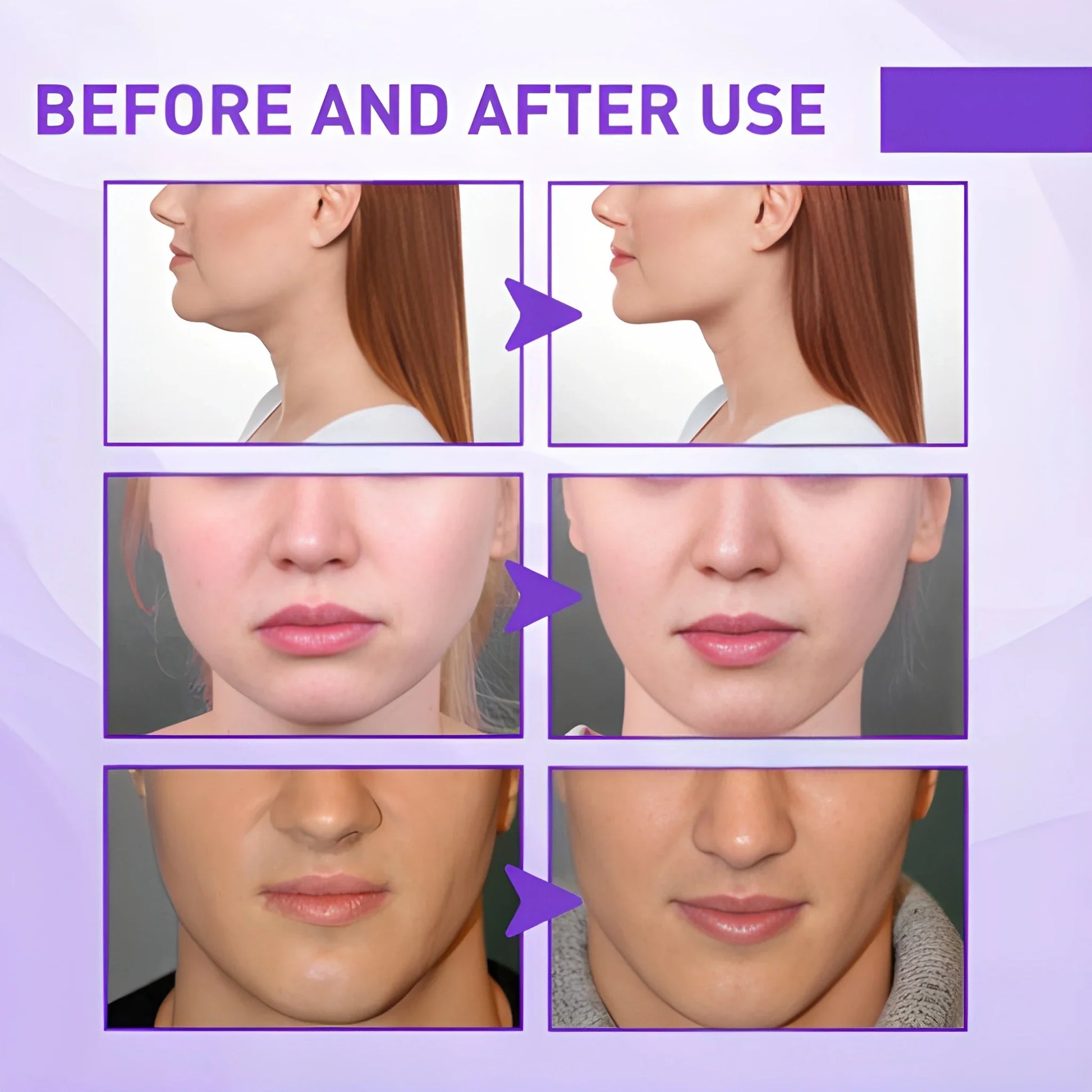 Jawline Slimming Face Cream