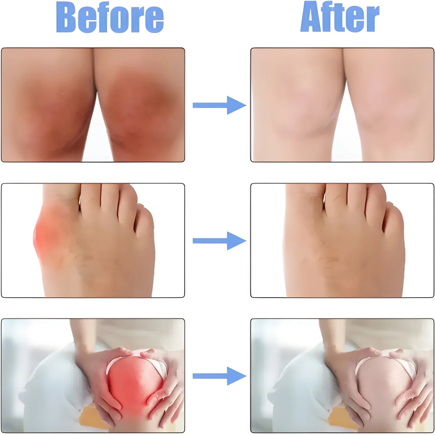 JointCare Comfort Spray – 30ml