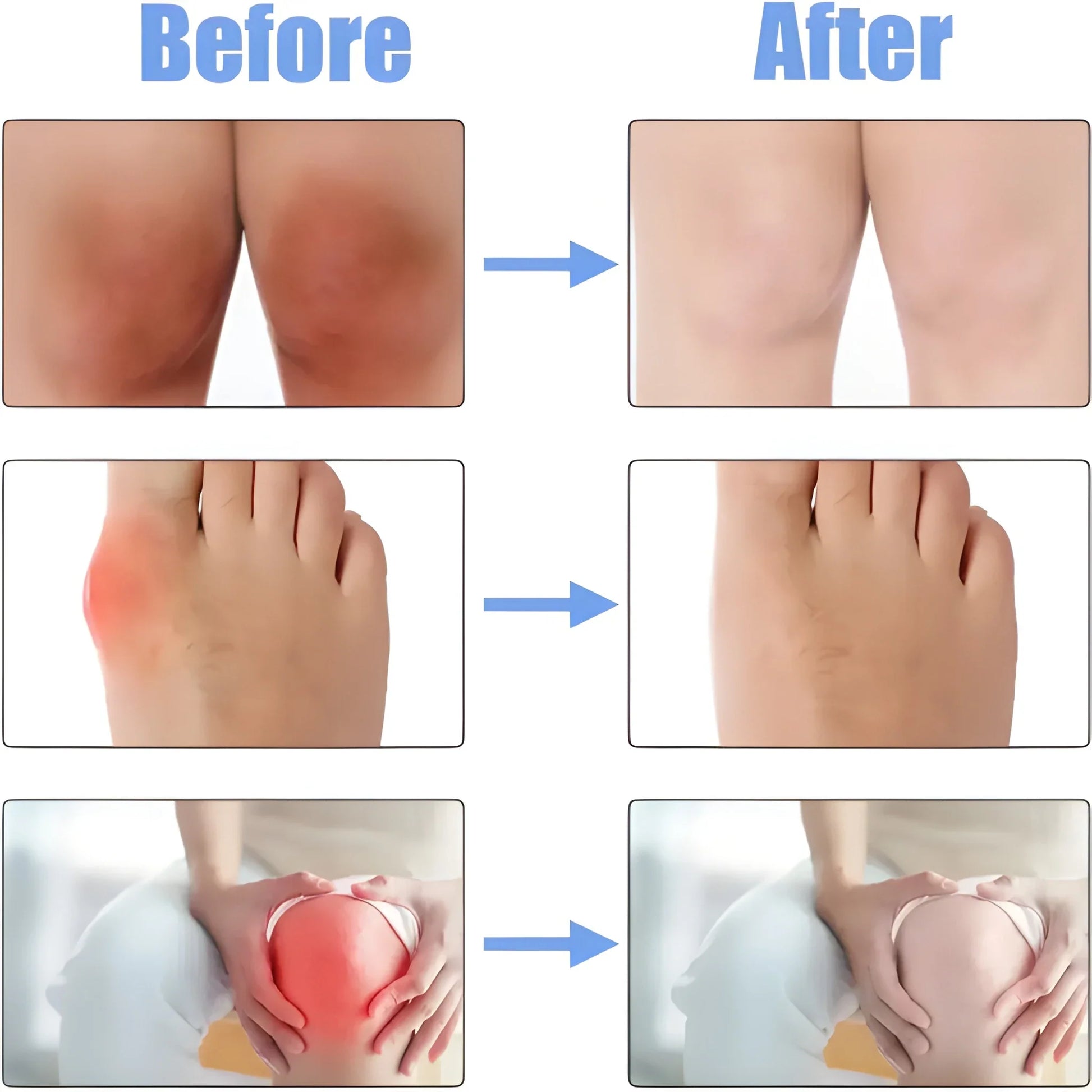 JointCare Comfort Spray – 30ml