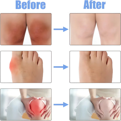 JointCare Comfort Spray – 30ml