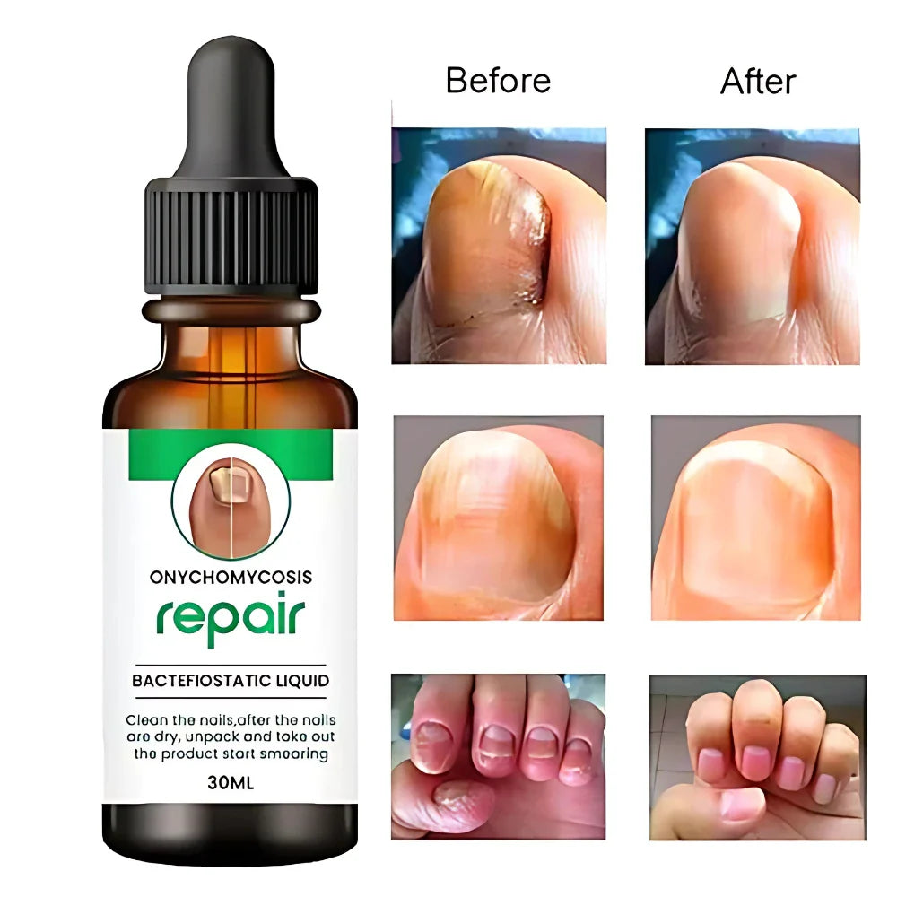 Nail Growth Repair Oil Personal Care